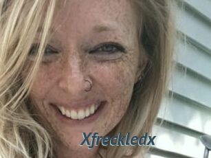 Xfreckledx